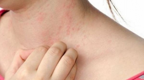 Phòng ngừa các bệnh về da (1/11/2018)