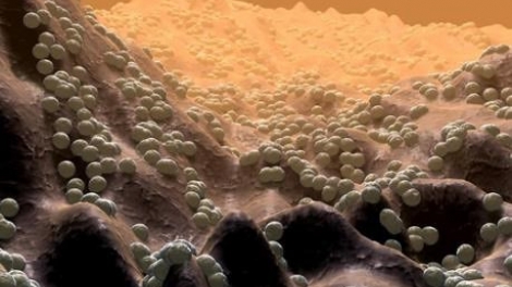 Phát hiện chủng vi khuẩn sống trên da người có thể ngăn chặn một số bệnh ung thư ác tính (Thời sự đêm 1/3/2018)