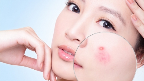 Phương pháp mới trong việc điều trị các bệnh khó chữa về da (1/6/2018)