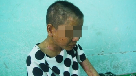 Từ vụ chủ quán cà phê ở Gia Lai bạo hành dã man người làm thuê, thêm một lần nữa đặt câu hỏi về trách nhiệm của chính quyền địa phương (24/7/2018)