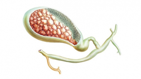 Những lưu ý về bệnh sỏi mật (25/11/2019)