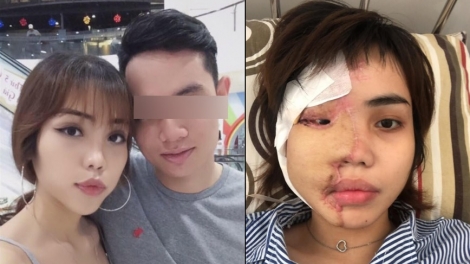Các vụ án tạt axít đang diễn ra ngày càng nhiều: Cần có hình thức xử phạt nghiêm khắc ra sao với hành vi độc ác này? (28/5/2019)