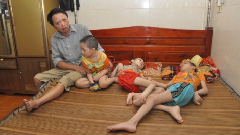 THỜI SỰ 12H TRƯA 10/8/2019: Hiện Việt Nam có 4,8 triệu người bị phơi nhiễm chất độc hóa học, trong đó có hơn 3 triệu người là nạn nhân chất độc da cam.
