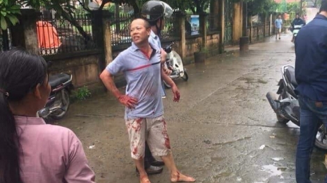 THỜI SỰ 18H00 CHIỀU 1/9/2019: Lực lượng công an khẩn trương điều tra vụ truy sát tại Hà Nội khiến 5 người trong một gia đình thương vong