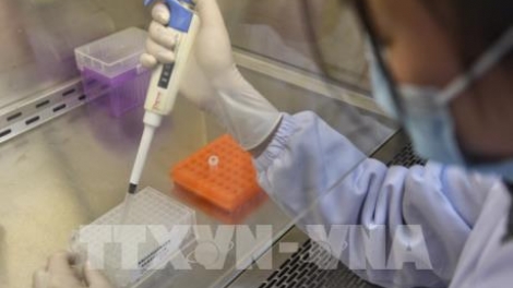 THỜI SỰ 12H TRƯA 11/2/2020: Bắt đầu thử nghiệm bộ Kit thử nhanh chủng virus Corona mới do Viện Vệ sinh dịch tễ Trung ương cung cấp.