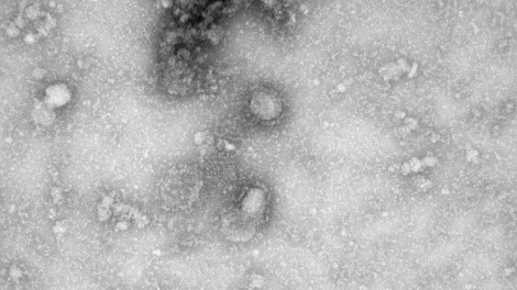 Các nhà khoa học Australia lại đạt tiến triển mới trong nghiên cứu virus corona (11/2/2020)