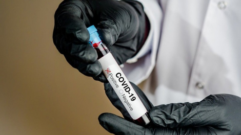Pháp cho dùng Chloroquine để trị Covid-19 khi số ca tử vong tăng kỷ lục (27/3/2020)