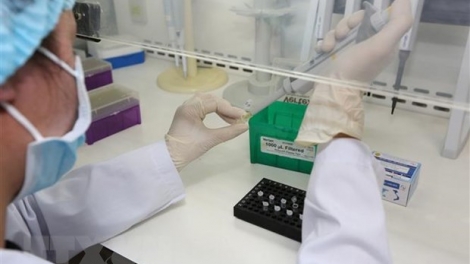 Bệnh viện Nhi Trung ương được thực hiện xét nghiệm virus SARS-CoV-2 (7/3/2020)
