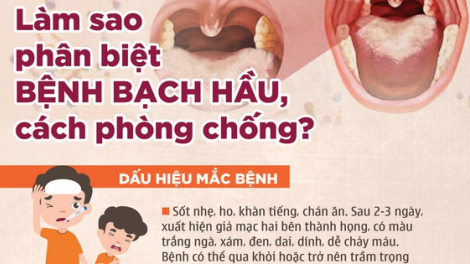 Cách phòng chống bệnh bạch hầu (30/6/2020)