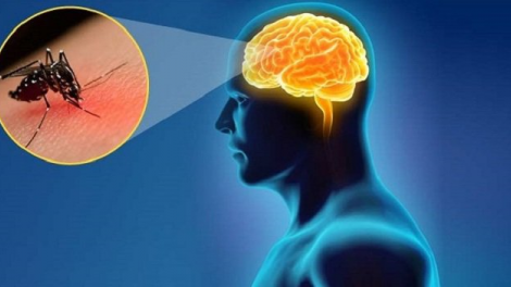 Cách phòng bệnh khi đến mùa viêm não Nhật bản (20/07/2020)