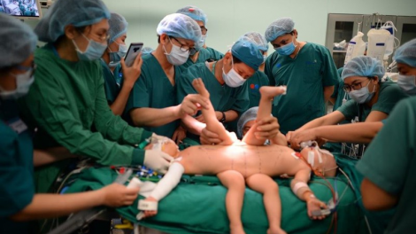 THỜI SỰ 6H SÁNG 16/7/2020: Thành công của ca phẫu thuật tách rời 2 em bé song sinh ở TP.HCM đánh dấu sự tiến bộ vượt bậc của nền y tế nước nhà