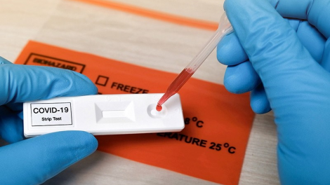 THỜI SỰ 18H CHIỀU 5/10/2021: Bộ Y tế đề nghị kiểm tra việc mua sắm các loại kit test nhanh Covid-19 và xét nghiệm RT-PCR