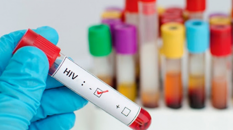 Người nhiễm HIV mắc Covid-19 nguy cơ tử vong tăng 30% (1/12/2021)