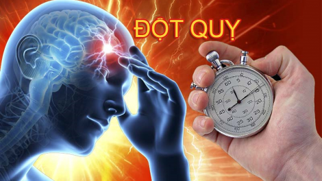 Kiểm soát ngăn ngừa bệnh đột quỵ (15/5/2021)