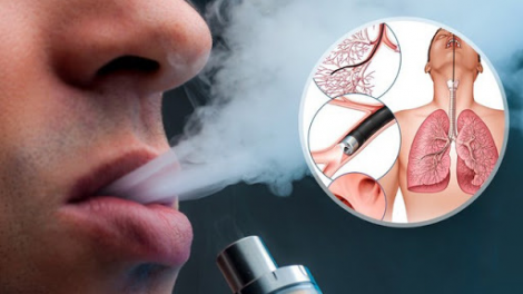 Tại Việt Nam, mỗi năm có ít nhất 40.000 ca tử vong do các bệnh liên quan đến thuốc lá (13/12/2023)