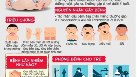 Tăng cường các biện pháp phòng tránh, không chủ quan với dịch bệnh tay chân miệng (18/06/2023)