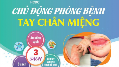 Nỗi lo dịch chồng dịch ở tpHCM (22/06/2023)