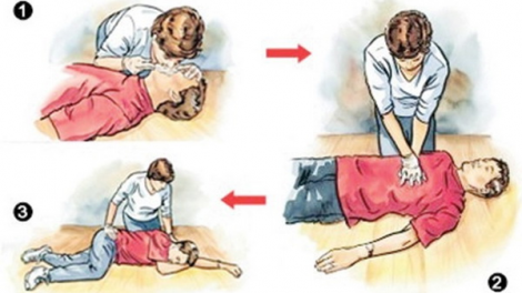 Cấp cứu đuổi nước đúng cách như thế nào (29/7/2023)