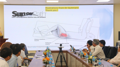 Phẫu thuật thay khớp háng với vết mổ chỉ còn 4cm, giảm 6 lần so với trước (17/10/2024)