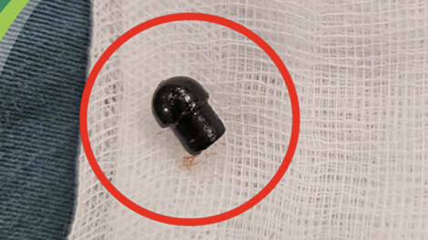 Sự cố xảy ra trong lớp học khiến bé gái 7 tuổi tử vong thương tâm (24/12/2024)