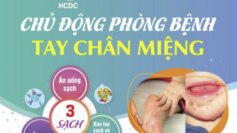 TPHCM: Tăng ca mắc tay chân miệng, giảm ca sốt xuất huyết (17/05/2024)