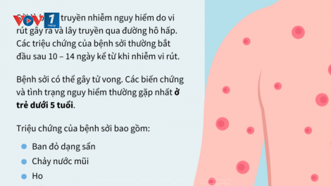 Phổ biến Bộ tài liệu truyền thông về bệnh sởi của Tổ chức Y tế Thế giới (22/03/2025)