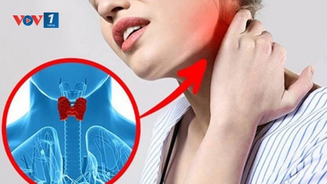 Gia tăng tỷ lệ người mắc bệnh nhiễm độc giáp (12/04/2025)