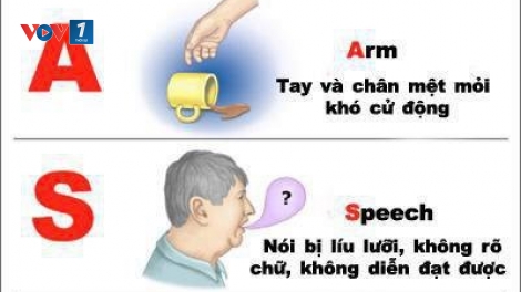 Điều trị kịp thời cho bệnh nhân đột quỵ