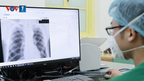Bộ Y tế đề nghị thanh toán BHYT kỹ thuật điện quang không phụ thuộc vào thời gian chụp chiếu