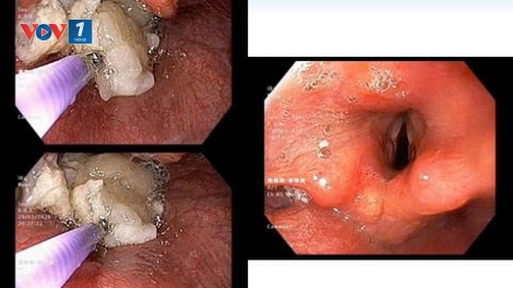 Xử trí thành công nhiều ca cấp cứu tình huống nguy hiểm