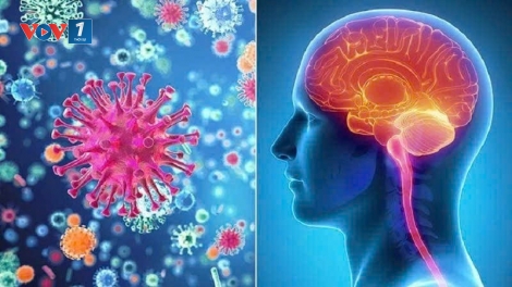 Cảnh giác viêm não mô cầu: “Sát thủ thầm lặng” với nguy cơ tử vong nhanh