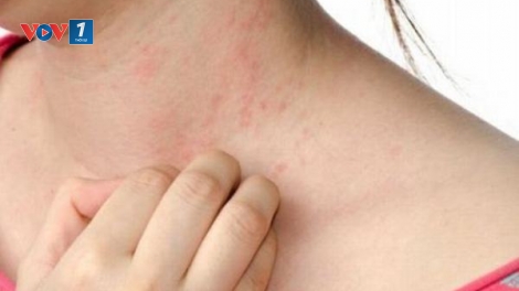 Phòng ngừa các bệnh về da (1/11/2018)