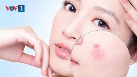 Phương pháp mới trong việc điều trị các bệnh khó chữa về da (1/6/2018)