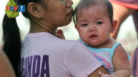 Tẩy chay vắc xin và nguy cơ bùng phát dịch sởi (15/2/2019)