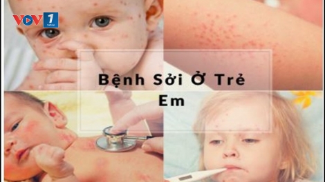 Tình trạng dịch sởi ở một số tỉnh thành đang diễn biến phức tạp (23/2/2019)