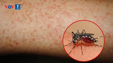 Dịch sốt xuất huyết đang ở mức đỉnh điểm (9/9/2019)