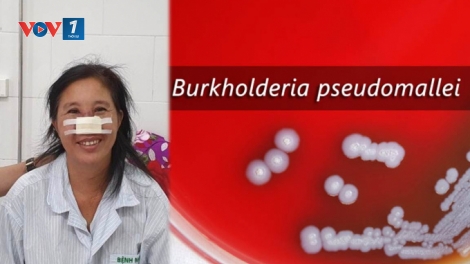 Nữ bệnh nhân 49 tuổi ở Bắc Kạn bị bệnh Whitmore gây tổn thương mũi đã được xuất viện (20/9/2019)