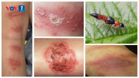 Lao động ngành du lịch vượt qua thách thức trong mùa dịch Covid 19 (21/9/2020)