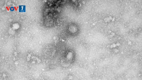 Các nhà khoa học Australia lại đạt tiến triển mới trong nghiên cứu virus corona (11/2/2020)