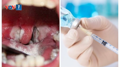 Dịch bạch hầu: Ngăn chặn các nguy cơ dịch bệnh từ “vùng lõm” tiêm chủng (30/6/2020)