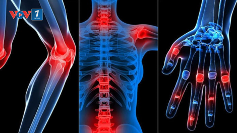 Tư vấn phòng ngừa, điều trị bệnh lý xương khớp trong cộng đồng (29/9/2020)