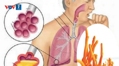 Tác dụng của Đông trùng hạ thảo cho người mắc các bệnh về đường hô hấp (13/11/2021)