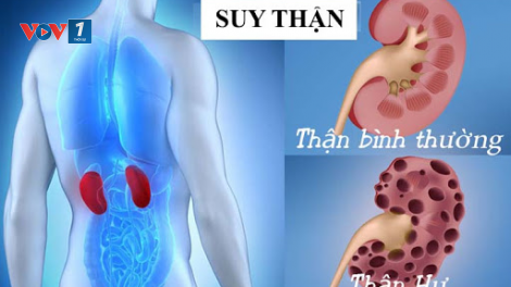 Tại sao người có chức năng gan, thận suy giảm không nên uống thuốc tây hạ đường huyết? (4/3/2023)