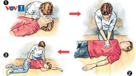 Cấp cứu đuổi nước đúng cách như thế nào (29/7/2023)