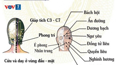Điều trị những di chứng sau tai biến mạch máu não bằng đông y. (05/4/2016)
