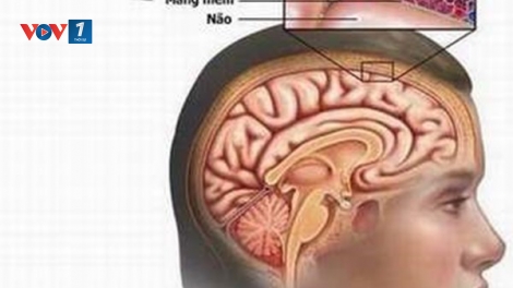 Hải Dương có bệnh nhân đầu tiên tử vong do bệnh viêm não mô cầu. (Thời sự đêm 23/02/2016)