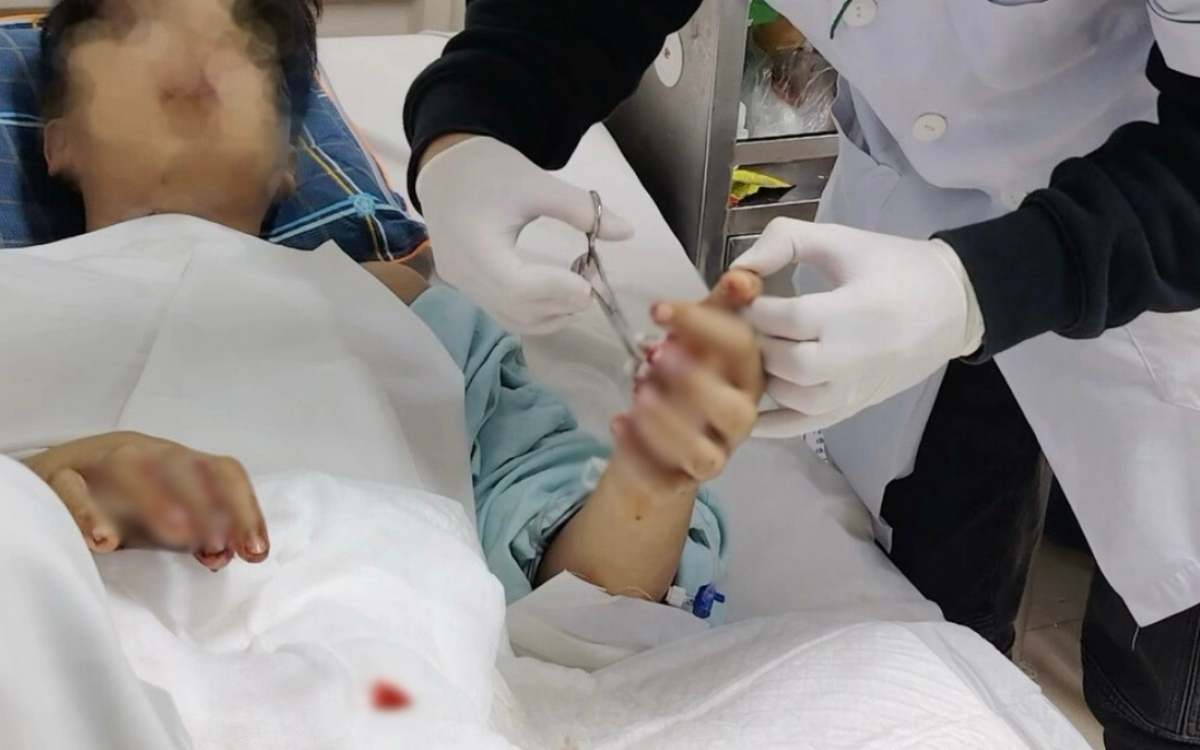 Bệnh viện Việt Đức đã cấp cứu 6 ca đa chấn thương do pháo nổ ngay trong tuần đầu tiên năm 2026