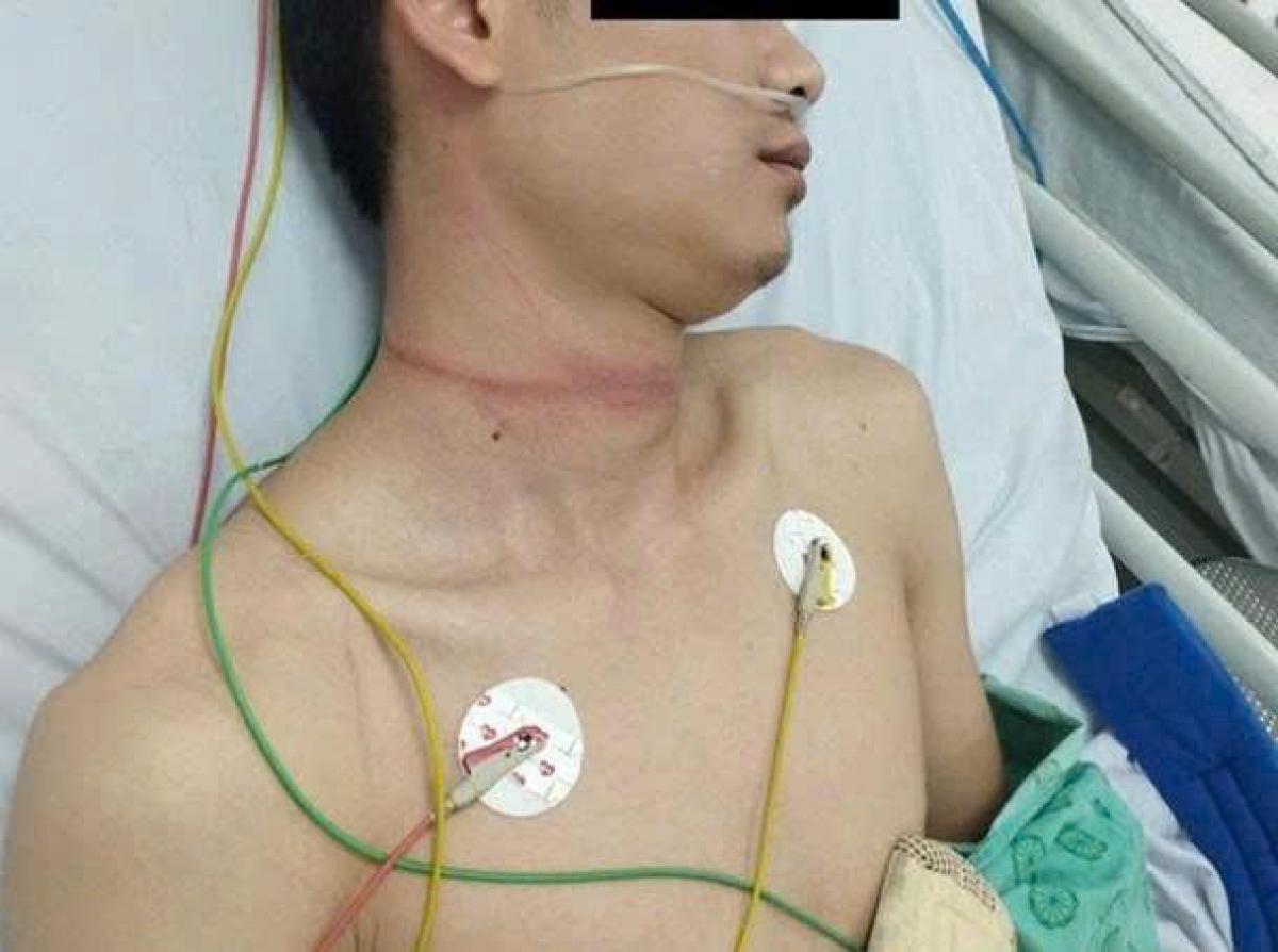 Ngưởi bệnh đã được các bác sỹ điều trị ổn định tại BV đa khoa Hà Đông