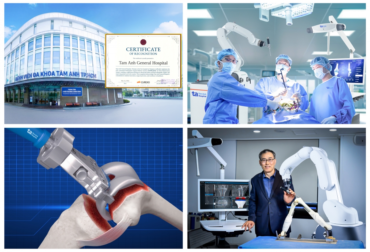 Ông Jae-Jun LEE - Giám đốc điều hành hãng sản xuất Robot CUREXO, cho biết Bệnh viện Đa khoa Tâm Anh là đơn vị đầu tiên tại Việt Nam sở hữu và triển khai hệ thống Robot CUVIS-Joint, đánh dấu cột mốc quan trọng trong thúc đẩy phẫu thuật thay khớp chính xác và hiệu quả cao cho người bệnh tại Việt Nam.