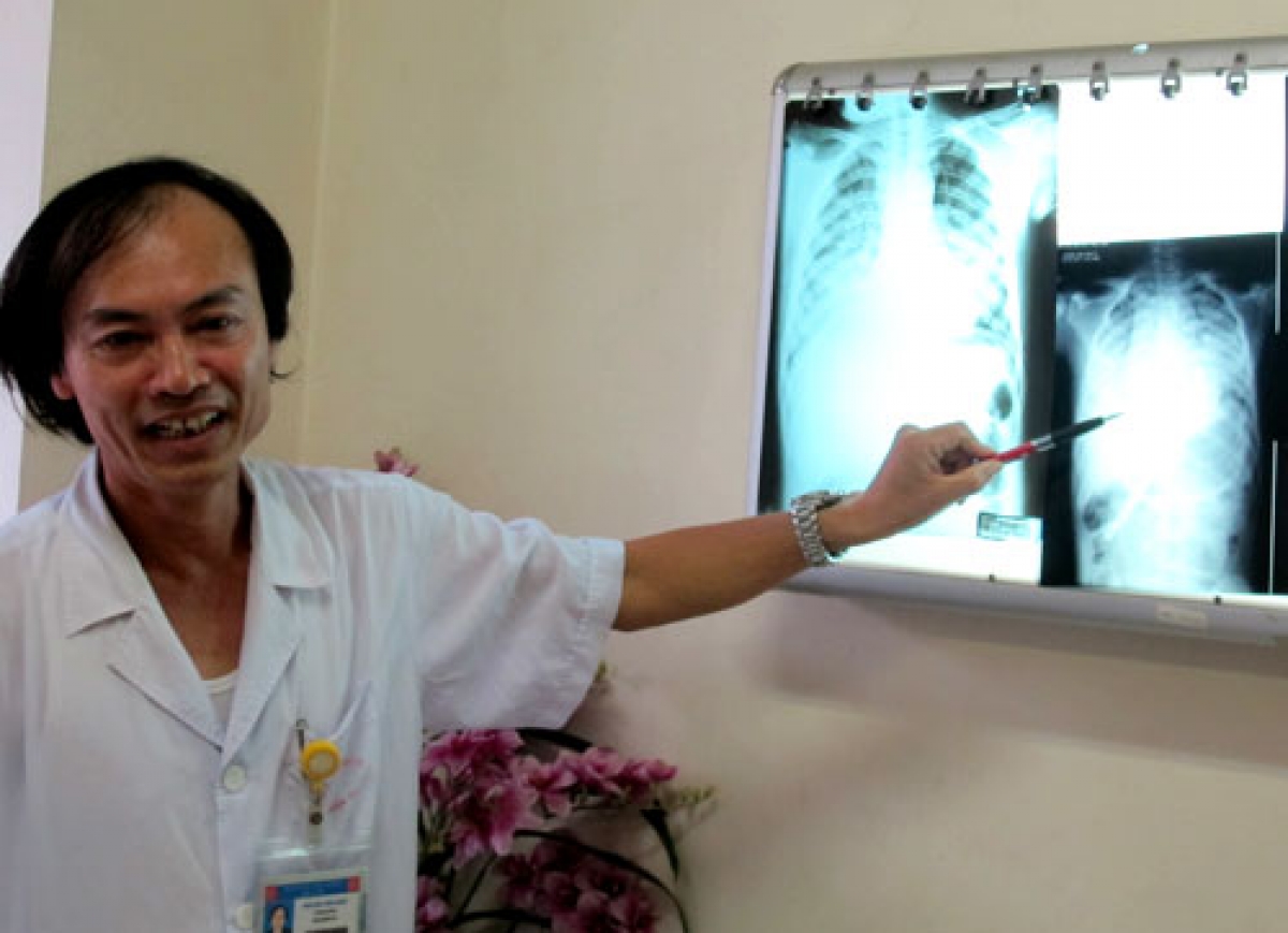GS.TS.BS Nguyễn Tiến Dũng, nguyên Trưởng khoa Nhi, BV Bạch Mai trong bài giảng cho các học viên cơ sở y tế tuyến dưới